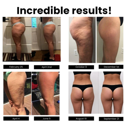 Legging anti-cellulite Sleemz™